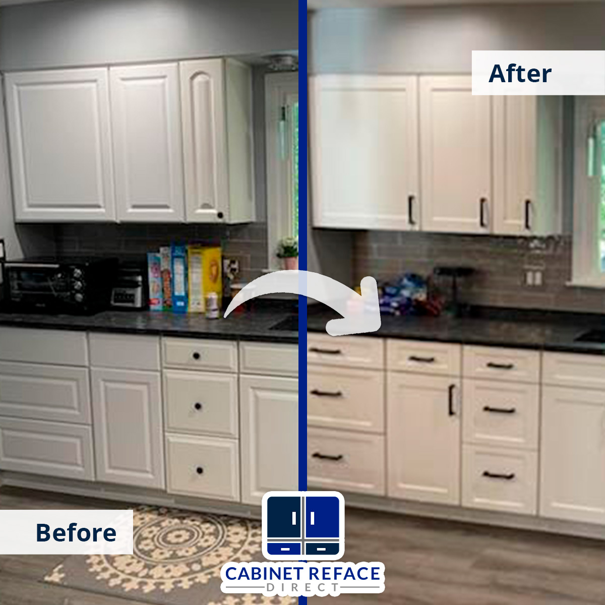 How Long Does Refacing Take?